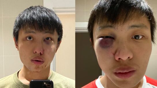 Jonathan Mok, v&iacute;ctima de agresi&oacute;n racista