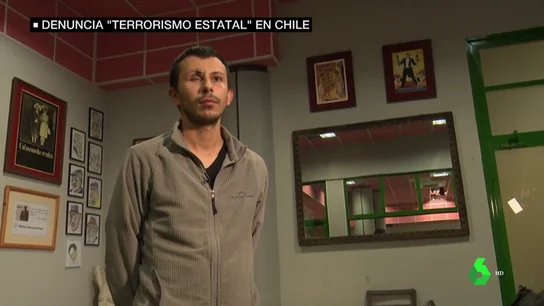 Matías perdió un ojo cuando una protesta le sorprendió en la calle Matías perdió un ojo cuando una protesta le sorprendió en la calle