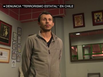 Matías perdió un ojo cuando una protesta le sorprendió en la calle Matías perdió un ojo cuando una protesta le sorprendió en la calle