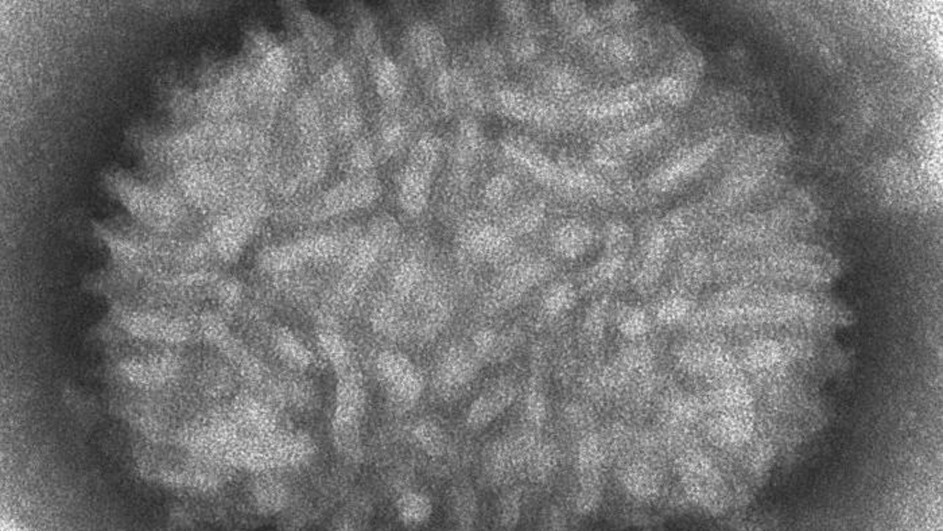 La busqueda de una vacuna para el coronavirus a partir del virus que erradico la viruela