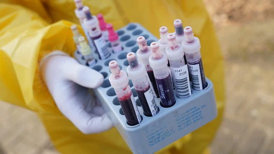 Coronavirus: Los nuevos síntomas de coronavirus Coronavirus
