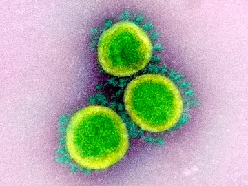 La OMS confirma que el coronavirus no viaja libremente por el aire sino en gotas La OMS confirma que el coronavirus no viaja libremente por el aire sino en gotas