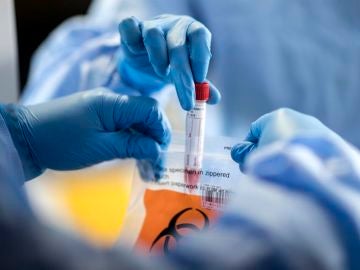 Las muestras de sangre no son necesarias para el diagnóstico de coronavirus mediante este innovador método Las muestras de sangre no son necesarias para el diagnóstico de coronavirus mediante este innovador método