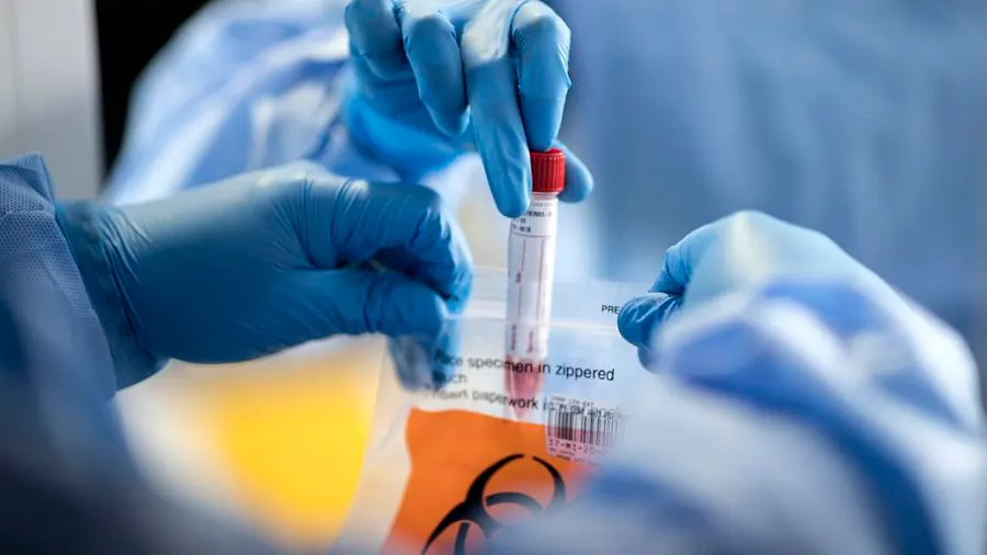 Las muestras de sangre no son necesarias para el diagnóstico de coronavirus mediante este innovador método