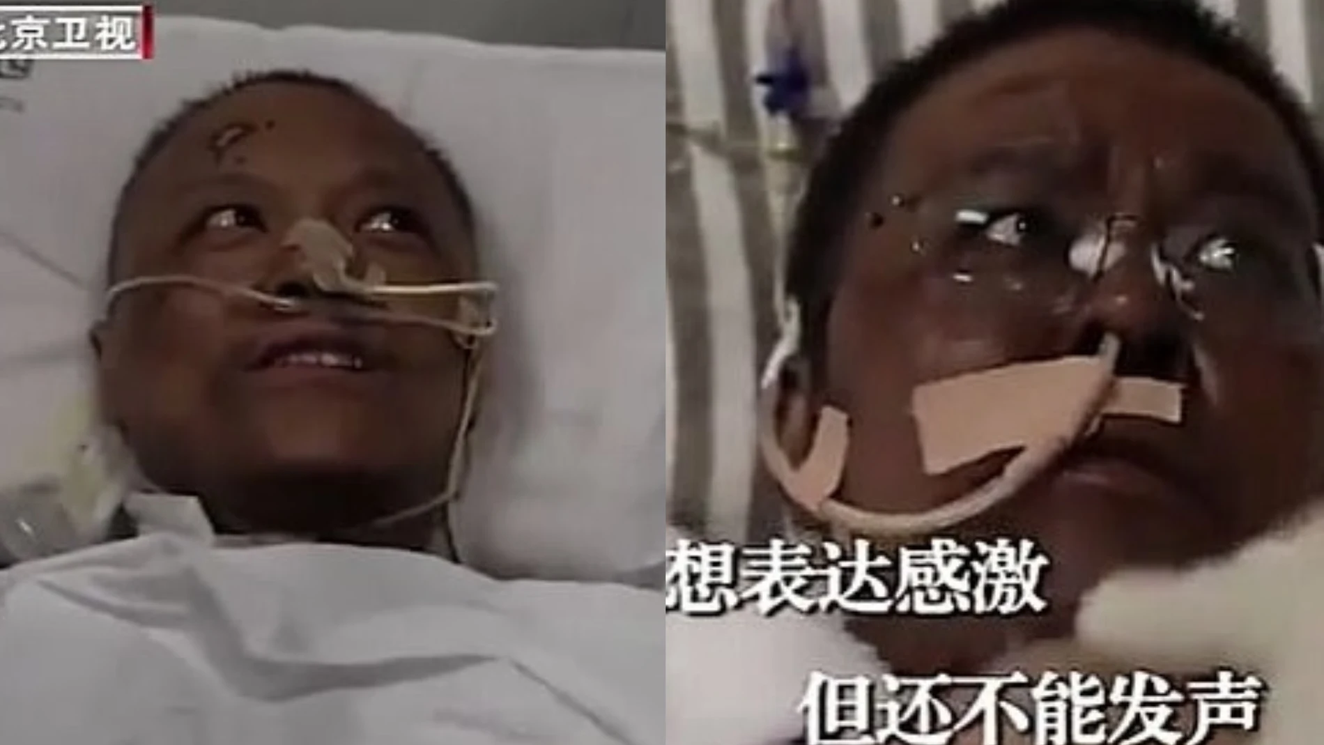 El doctor Yi Fan y el doctor Hu Weifeng, tras recibir el tratamiento