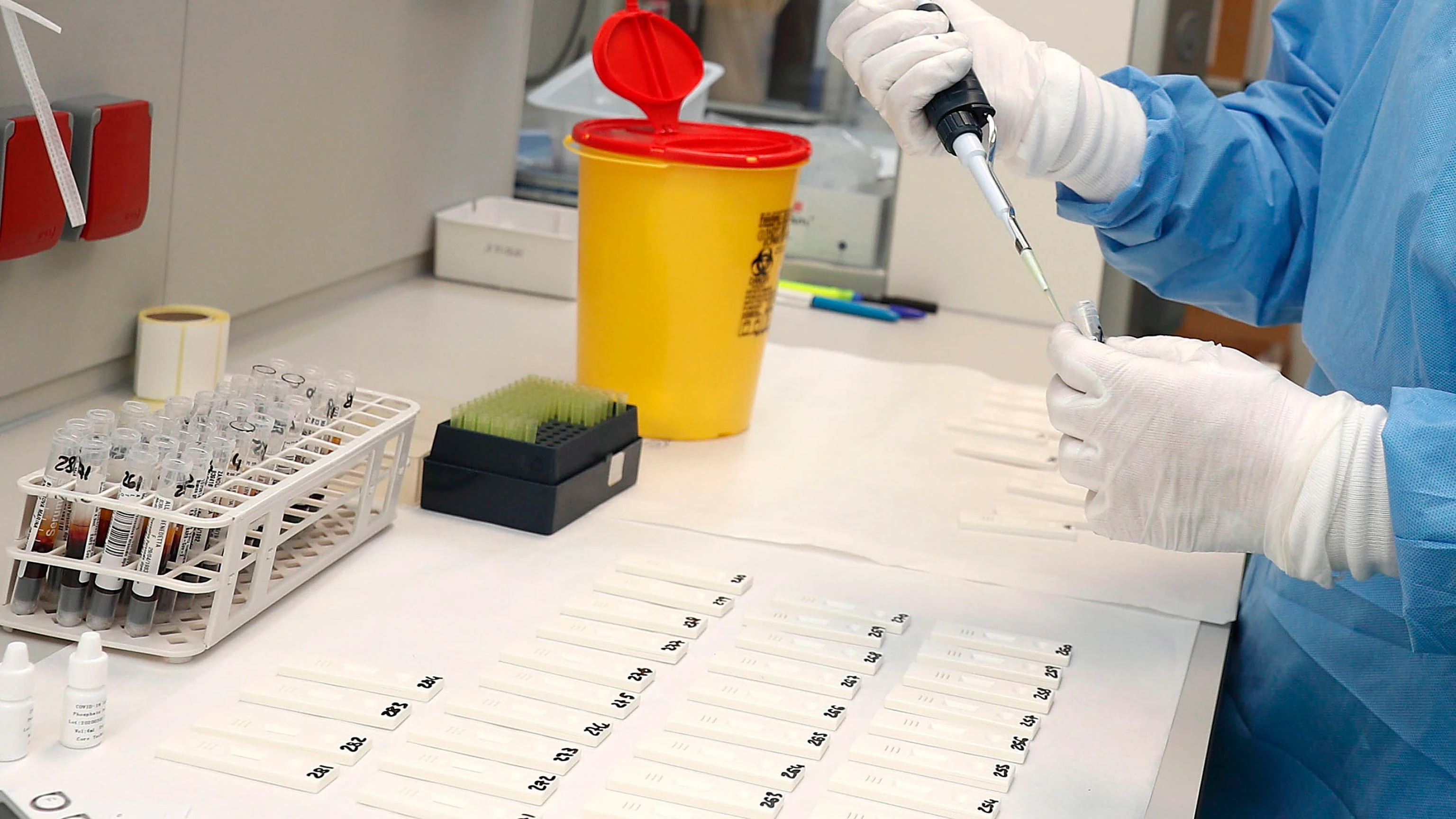 Imagen de un ensayo clínico en un laboratorio