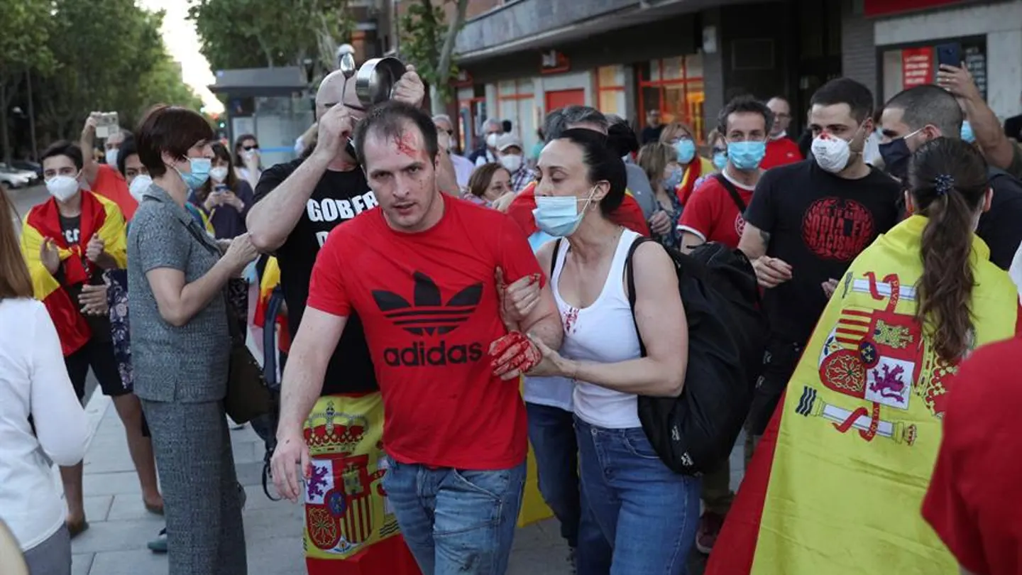 Imagen del hombre herido durante las protestas en el barrio de Moratalaz Imagen del hombre herido durante las protestas en el barrio de Moratalaz
