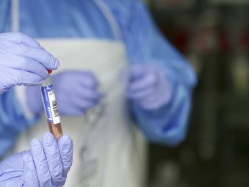 Muestra de coronavirus de un laboratorio Muestra de coronavirus de un laboratorio