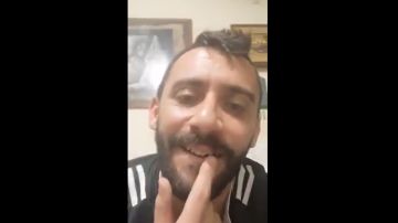 Álvaro Fernández muestra su diente roto en redes