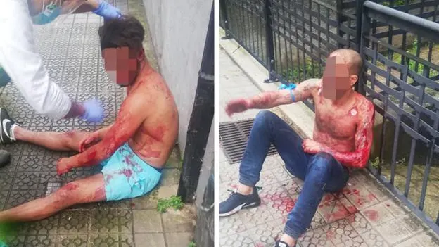 Dos hombres heridos tras una salvaje pelea en Bilbao