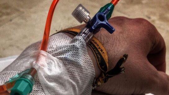 Imagen de Dani Rovira durante su sexta sesi&oacute;n de quimioterapia