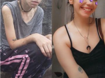 El impactante cambio de una joven de 24 años tras superar su adicción a las drogas El impactante cambio de una joven de 24 años tras superar su adicción a las drogas