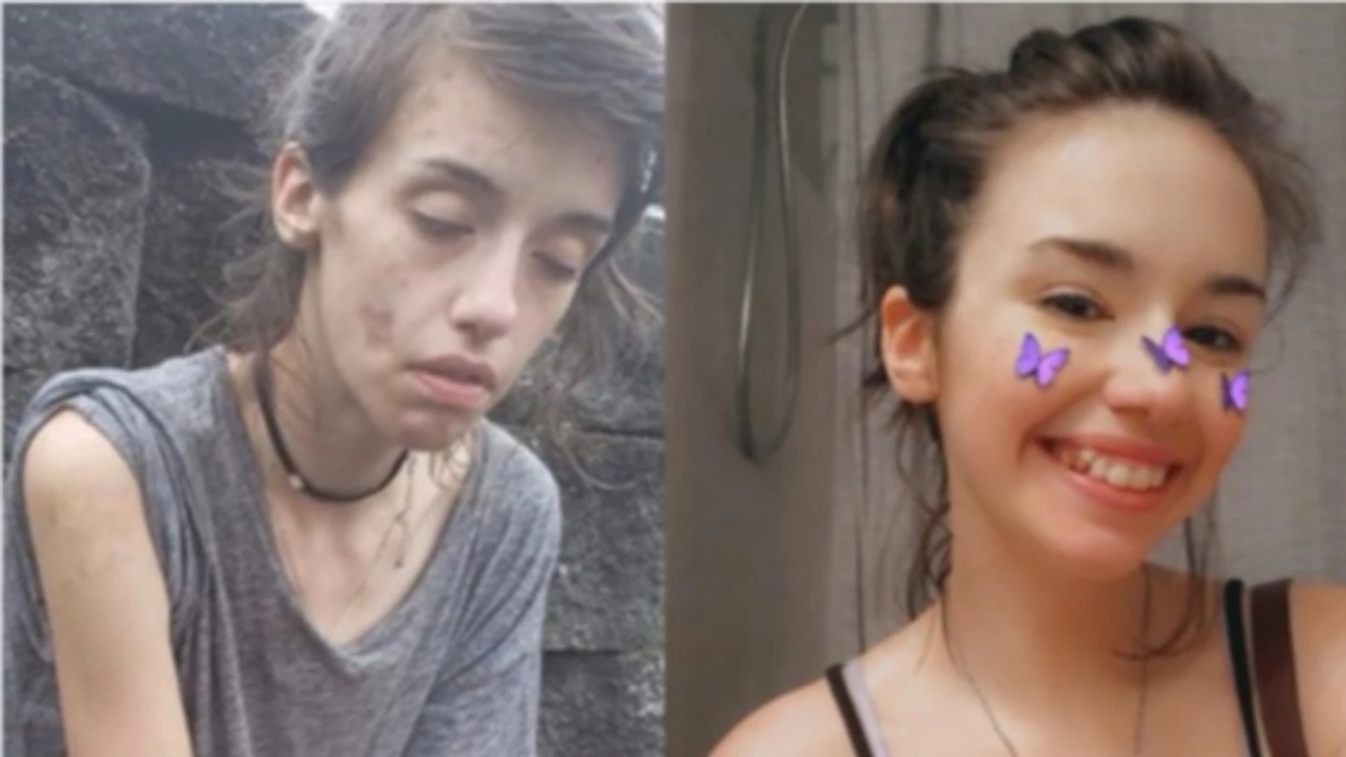 El impactante cambio de una joven de 24 años tras superar su adicción a las drogas