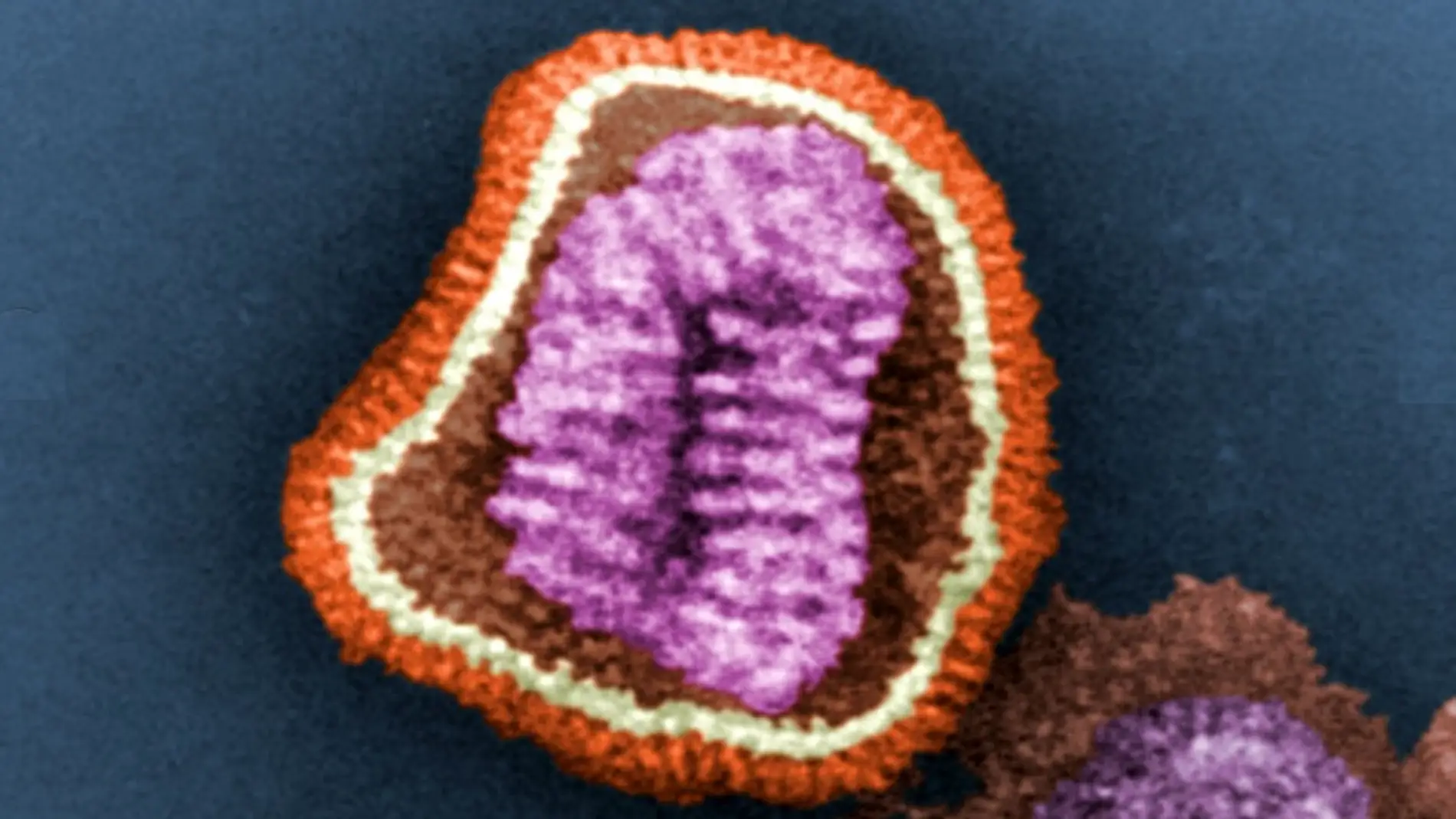 Virus de la gripe