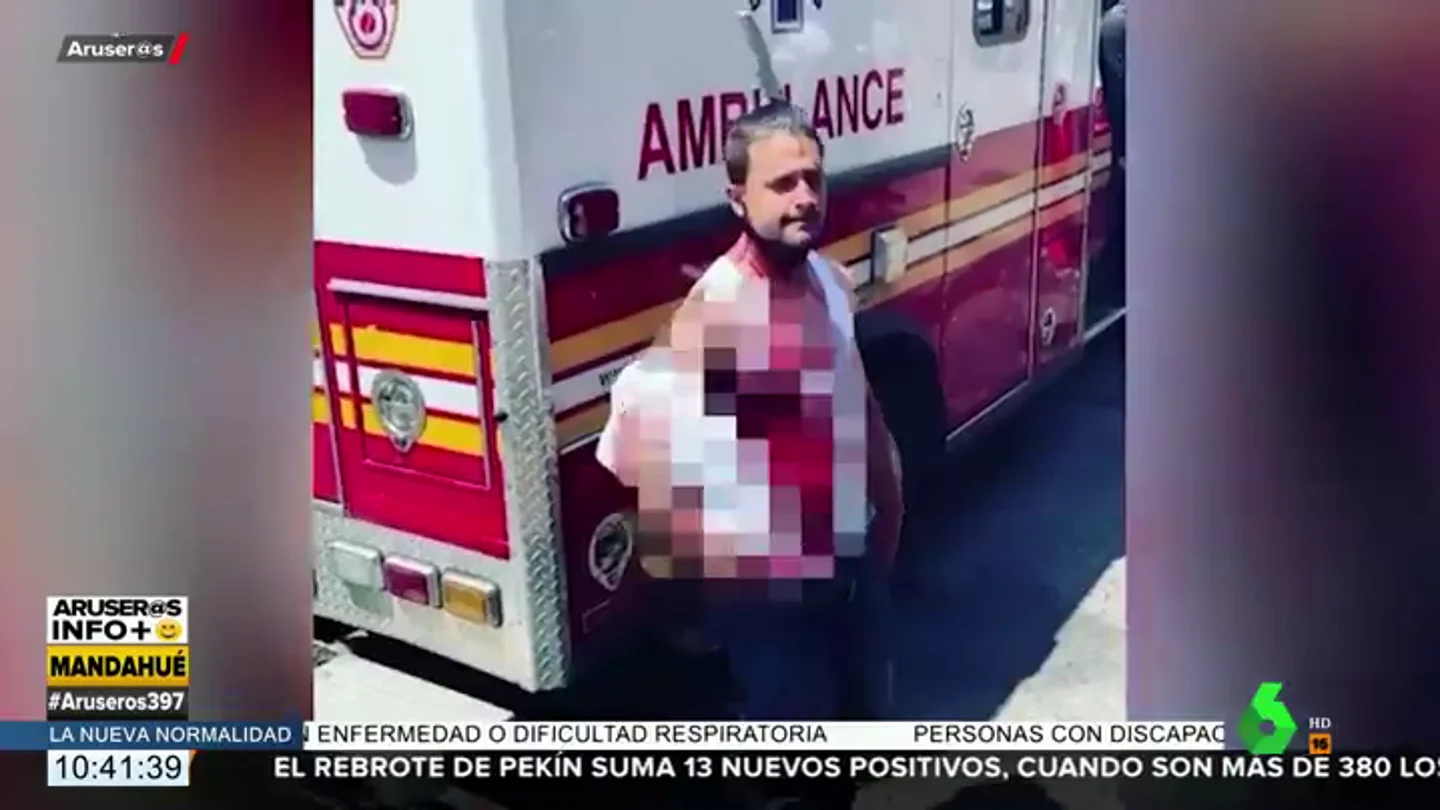 El momento en el que graban a un hombre con un cuchillo clavado en la cabeza El momento en el que graban a un hombre con un cuchillo clavado en la cabeza