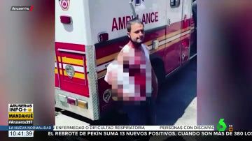 El momento en el que graban a un hombre con un cuchillo clavado en la cabeza