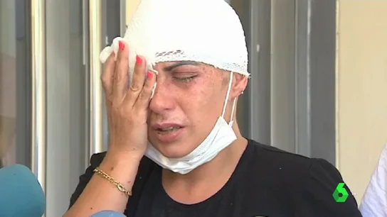 El hombre que quemó con sosa cáustica a una mujer alega que fue un accidente El hombre que quemó con sosa cáustica a una mujer alega que fue un accidente