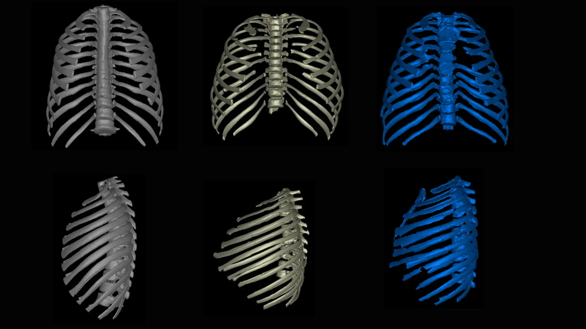 El Homo erectus no era esbelto y ligero sino compacto achaparrado y robusto