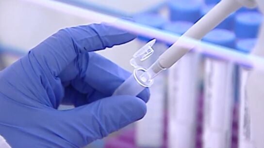 An&aacute;lisis aguas fecales