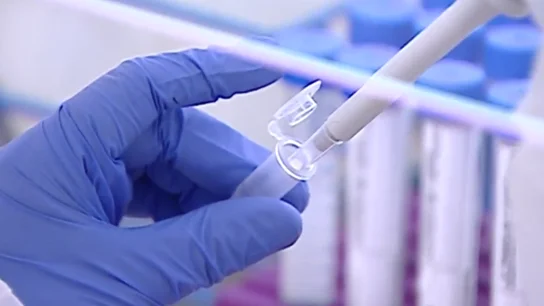 Análisis aguas fecales Análisis aguas fecales