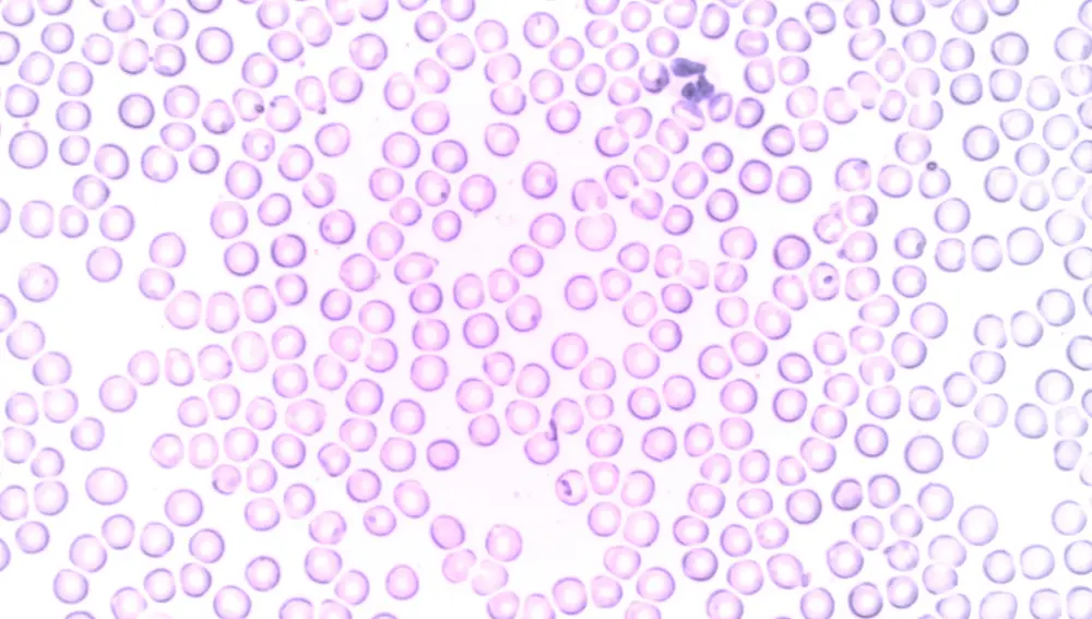 Glóbulos blancos Glóbulos blancos