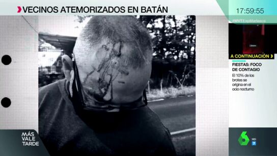Palizas, amenazas y p&aacute;nico en Bat&aacute;n, un barrio donde crece la violencia: &ldquo;Me rajaron el cuello con una botella&rdquo;