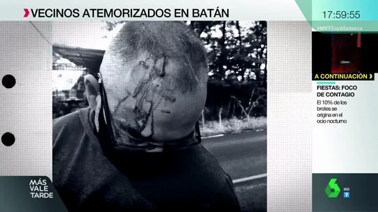 Palizas, amenazas y pánico en Batán, un barrio donde crece la violencia: “Me rajaron el cuello con una botella” Palizas, amenazas y pánico en Batán, un barrio donde crece la violencia: “Me rajaron el cuello con una botella”