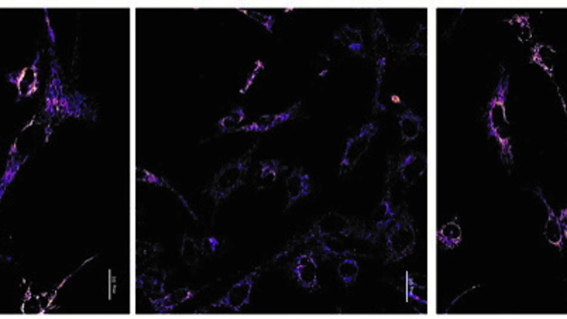 ADN mitocondrial 