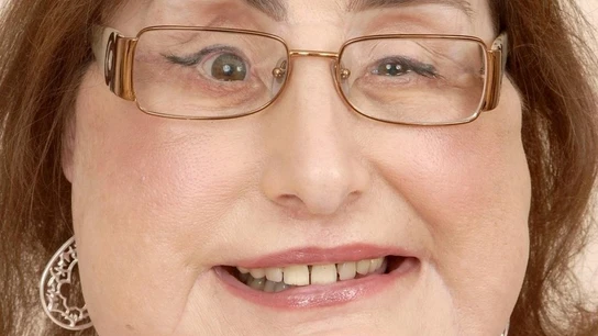 Connie Culp, la mujer que en 2008 recibió el primer trasplante facial Connie Culp, la mujer que en 2008 recibió el primer trasplante facial