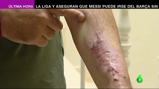 Trombos, paralización de órganos o neumonías incurables: el diagnóstico de algunos pacientes con coronavirus Trombos, paralización de órganos o neumonías incurables: el diagnóstico de algunos pacientes con coronavirus