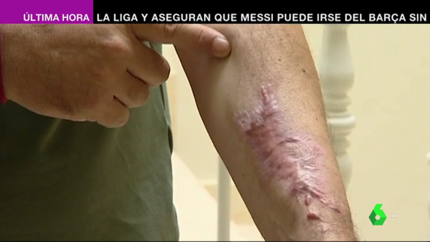 Trombos, paralización de órganos o neumonías incurables: el diagnóstico de algunos pacientes con coronavirus Trombos, paralización de órganos o neumonías incurables: el diagnóstico de algunos pacientes con coronavirus