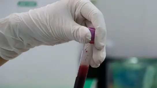 Un sanitario sostiene una muestra Un sanitario sostiene una muestra