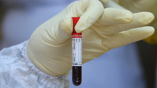 Un científico sostiene una muestra de sangre Un científico sostiene una muestra de sangre