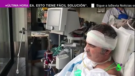 Oxigenación por ECMO: así es la técnica que ha devuelto calidad de vida a un paciente que llevaba 51 días ingresado por COVID Oxigenación por ECMO: así es la técnica que ha devuelto calidad de vida a un paciente que llevaba 51 días ingresado por COVID
