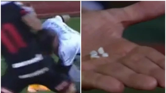 Rómulo Otero pierde cuatro dientes Rómulo Otero pierde cuatro dientes