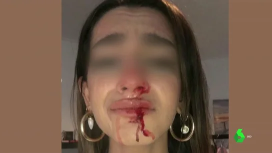 Una joven trans sufre una brutal paliza al grito de "puto travelo" y "engendro" a las puertas de su casa en Barcelona Una joven trans sufre una brutal paliza al grito de "puto travelo" y "engendro" a las puertas de su casa en Barcelona