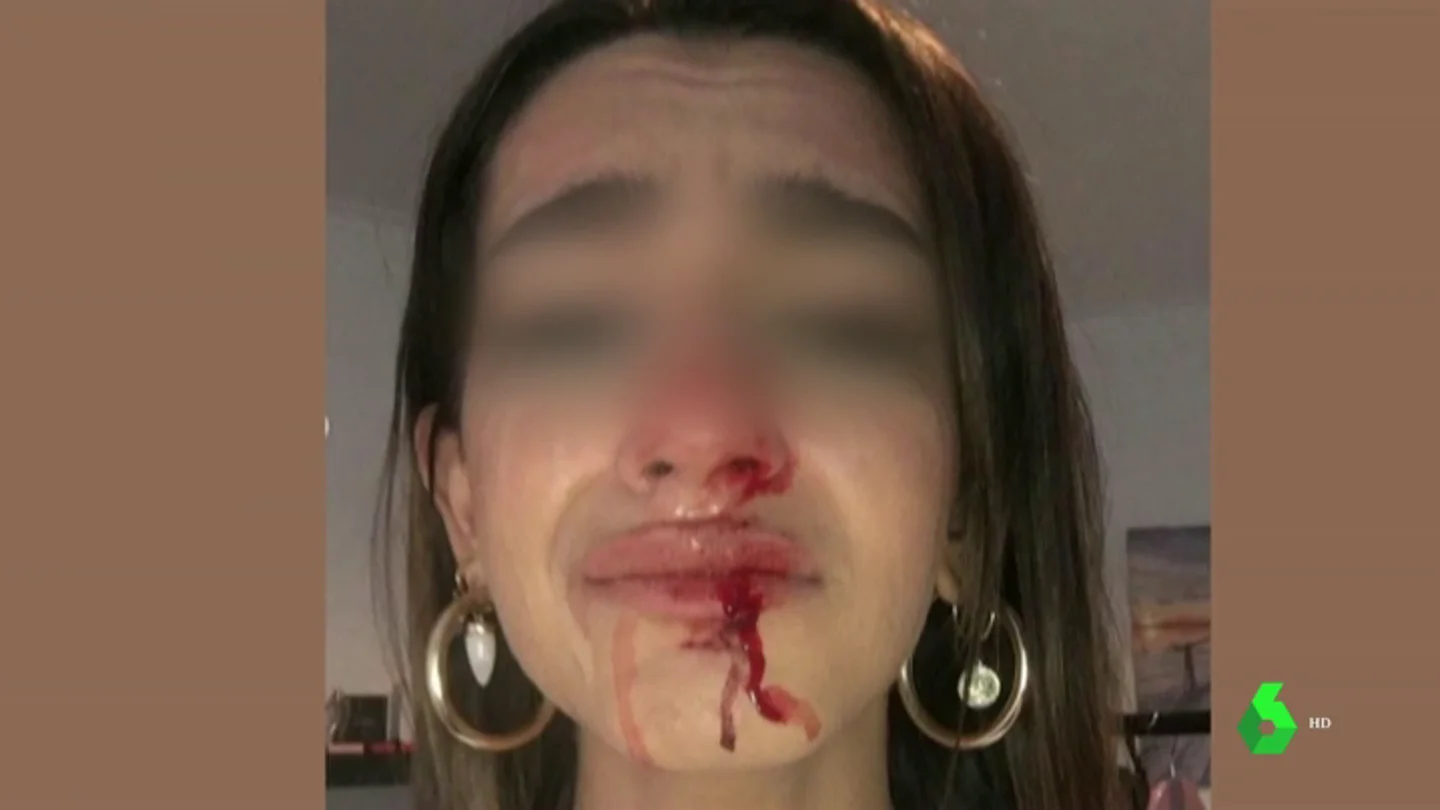 Una joven trans sufre una brutal paliza al grito de "puto travelo" y "engendro" a las puertas de su casa en Barcelona Una joven trans sufre una brutal paliza al grito de "puto travelo" y "engendro" a las puertas de su casa en Barcelona