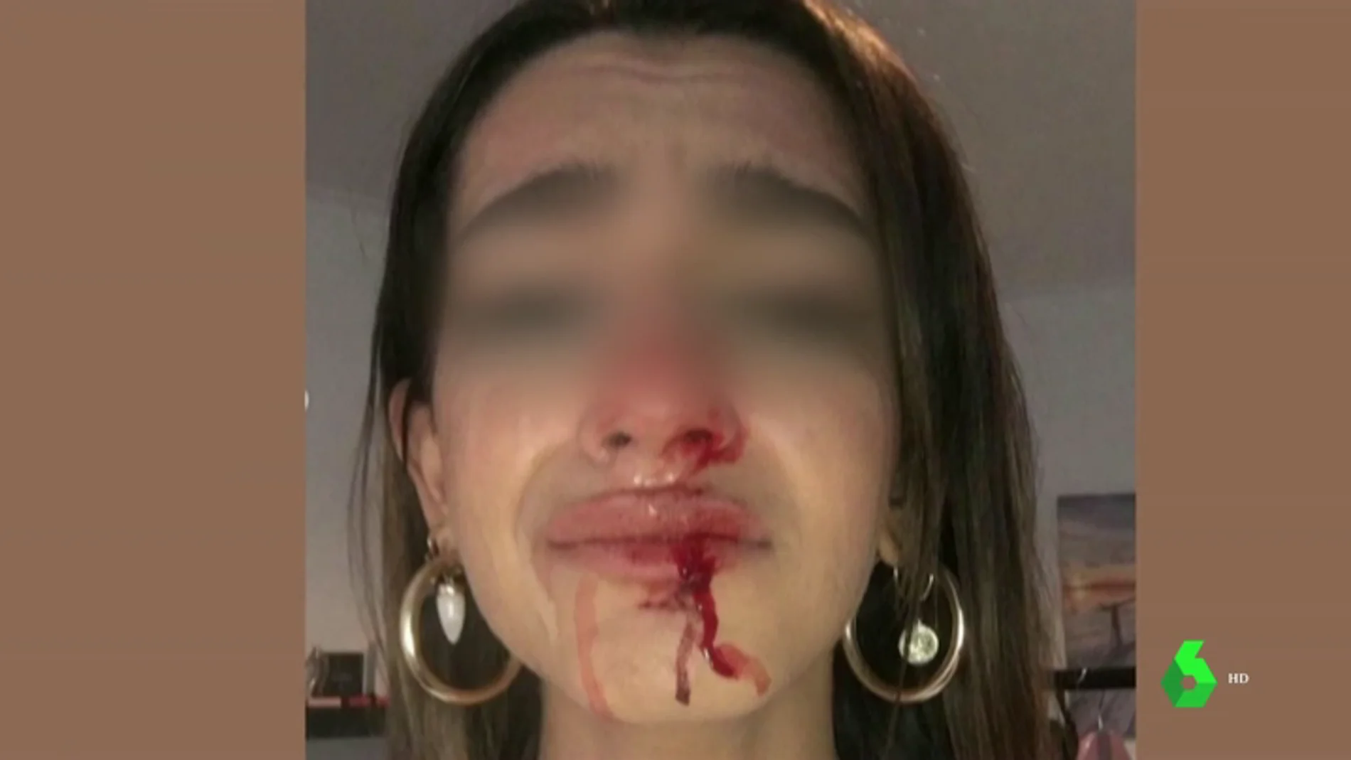 Una joven trans sufre una brutal paliza al grito de "puto travelo" y "engendro" a las puertas de su casa en Barcelona