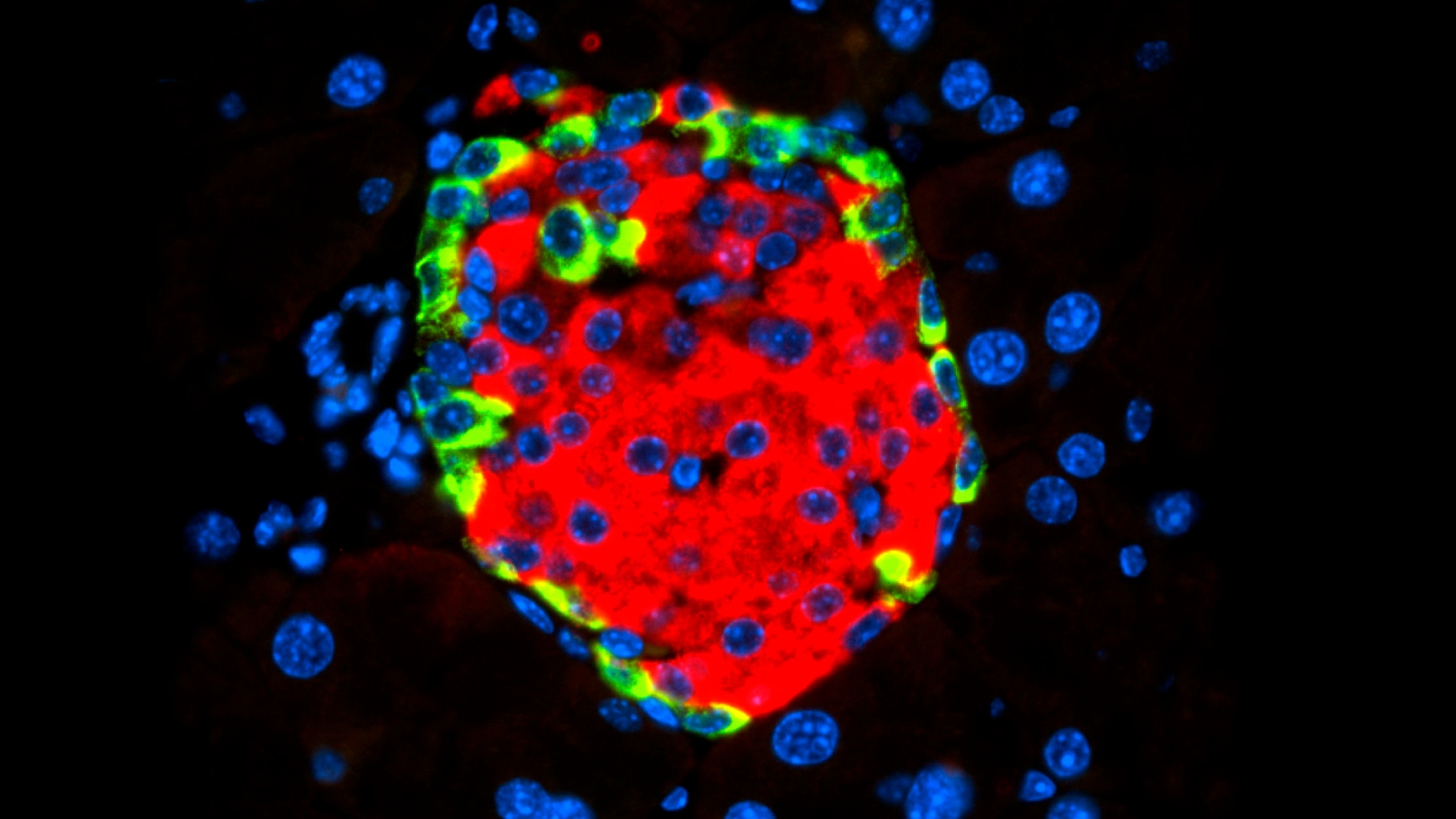 Este es el mecanismo molecular por el que un virus puede causar diabetes