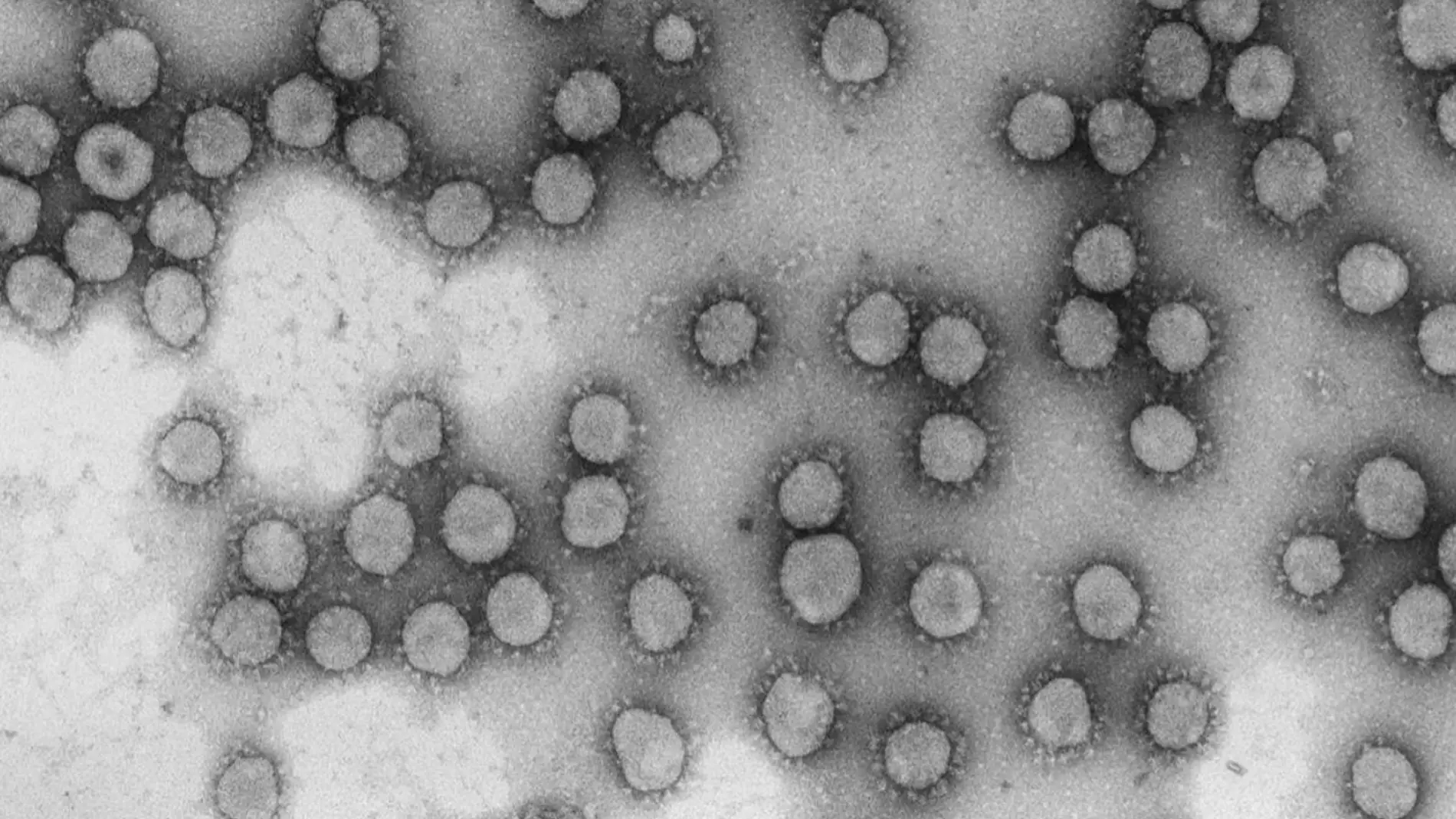 Un solo genotipo del coronavirus disparo los casos en Espana durante marzo