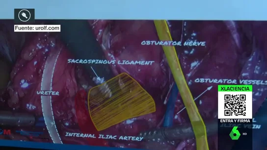Un médico español logra combatir con cirugía un síndrome casi desconocido Un médico español logra combatir con cirugía un síndrome casi desconocido