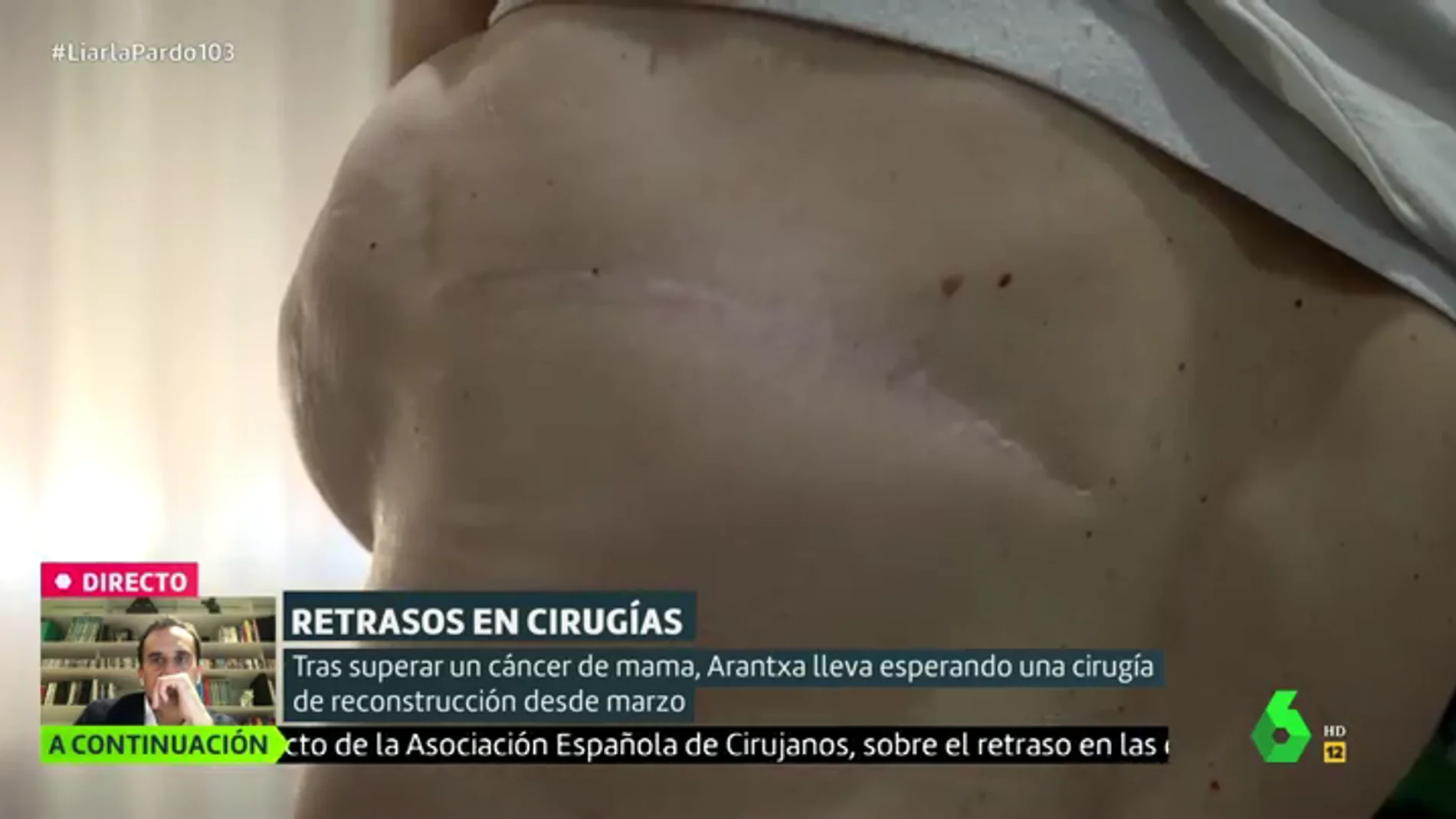 Arantxa, a la espera de una reconstrucción de mama desde marzo: "No es una cuestión psicológica, es vida"