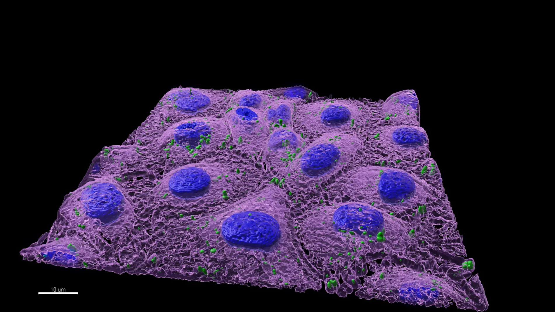 Los nanoplasticos alteran el microbioma intestinal