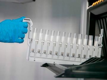 Probetas para los test PCR en un laboratorio de análisis. 
