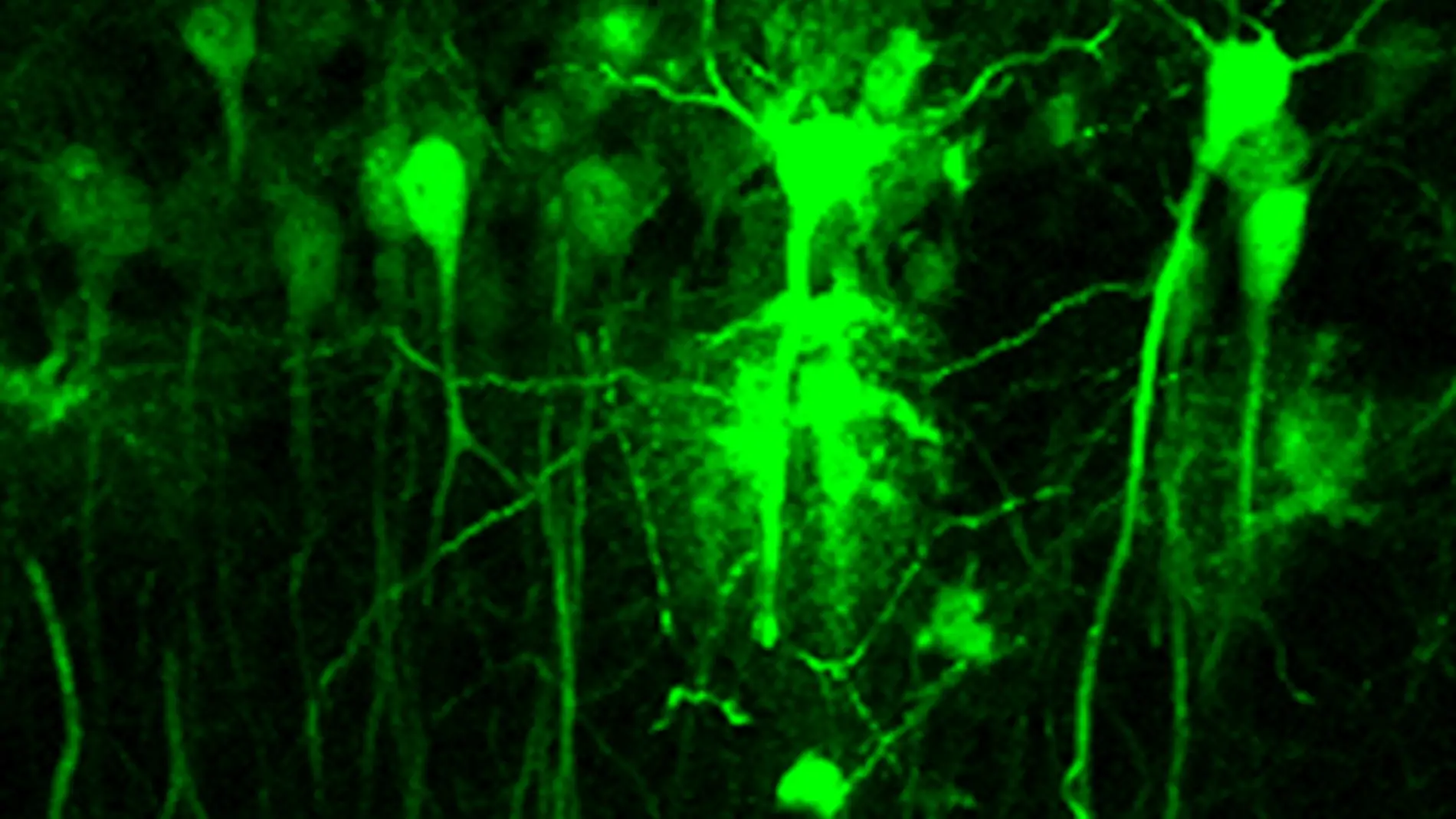 Neuronas hipocampales