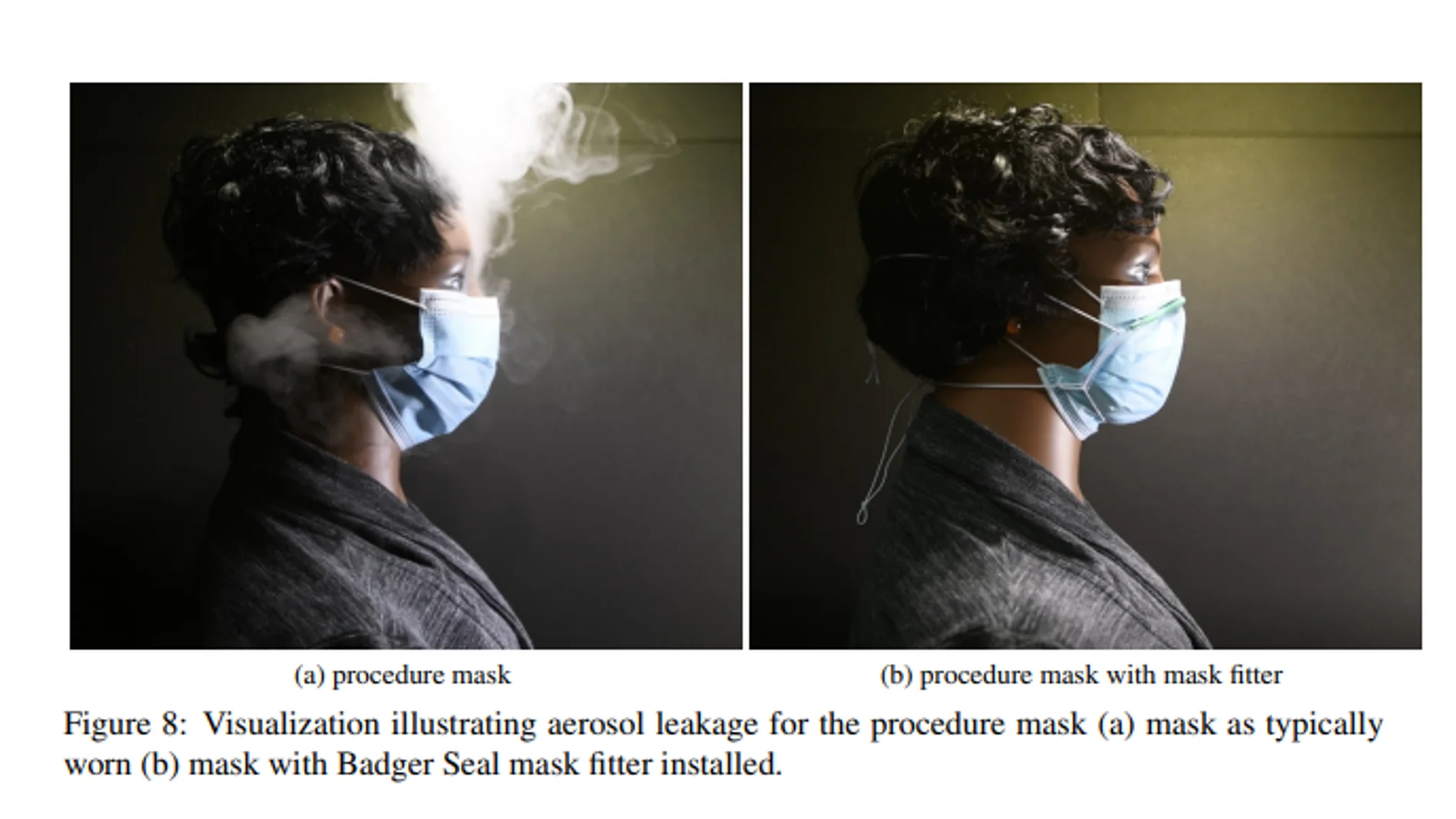 Los efectos de un ajustador en una mascarilla quirúrgica