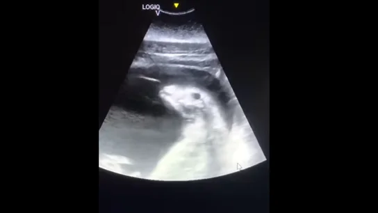 Ecografía de una ballena beluga embarazada Ecografía de una ballena beluga embarazada