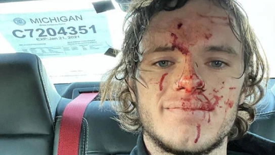 Imagen del youtuber estadounidense que se disparó accidentalmente en la cabeza Imagen del youtuber estadounidense que se disparó accidentalmente en la cabeza