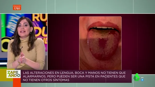 Llagas en la boca y la lengua, nuevo síntoma del COVID: Boticaria García te da las claves Llagas en la boca y la lengua, nuevo síntoma del COVID: Boticaria García te da las claves