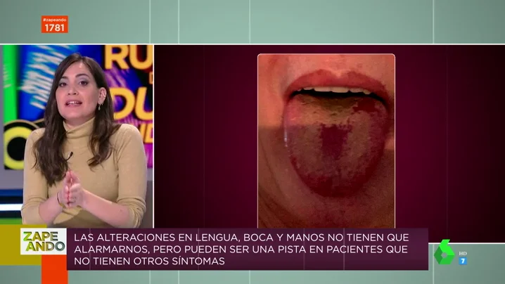 Llagas en la boca y la lengua, nuevo síntoma del COVID: Boticaria García te da las claves